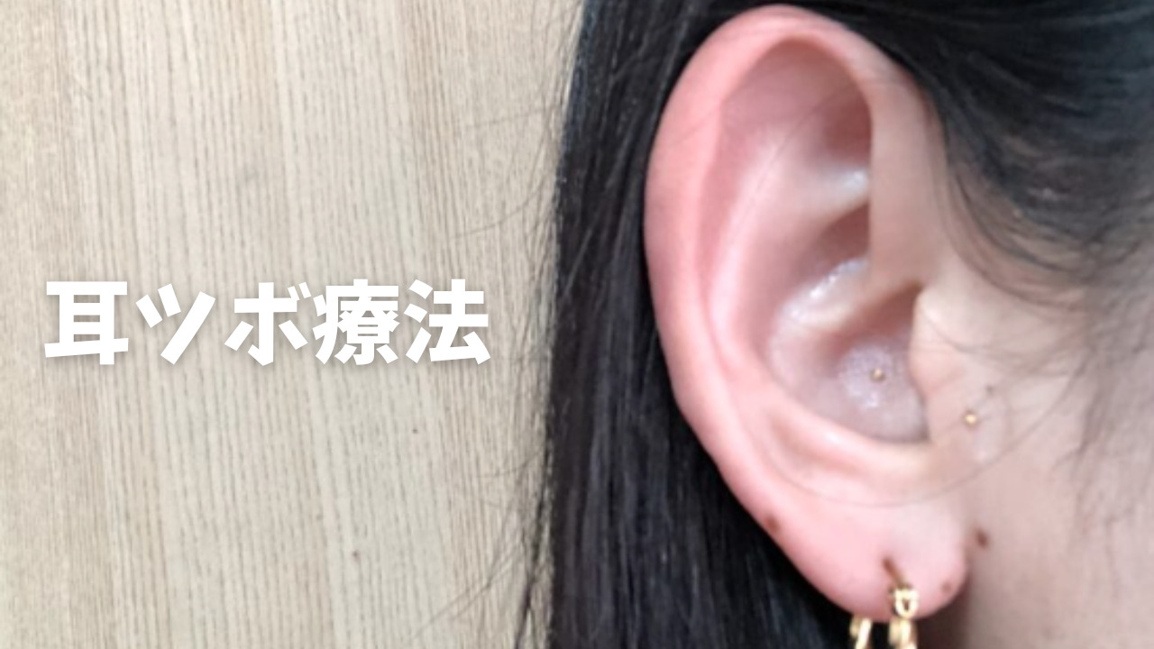 耳ツボ療法