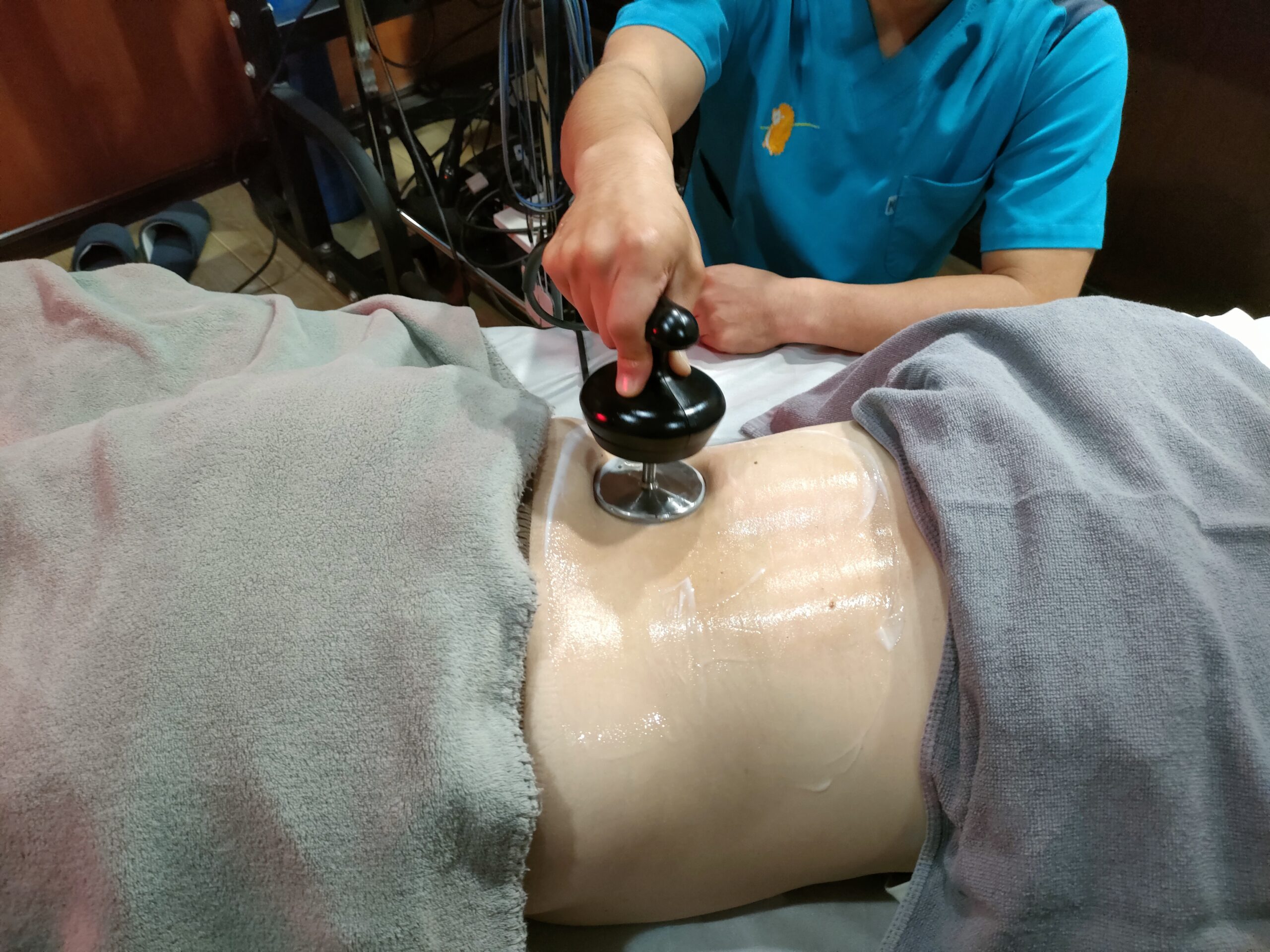 ラジオ波施術機器