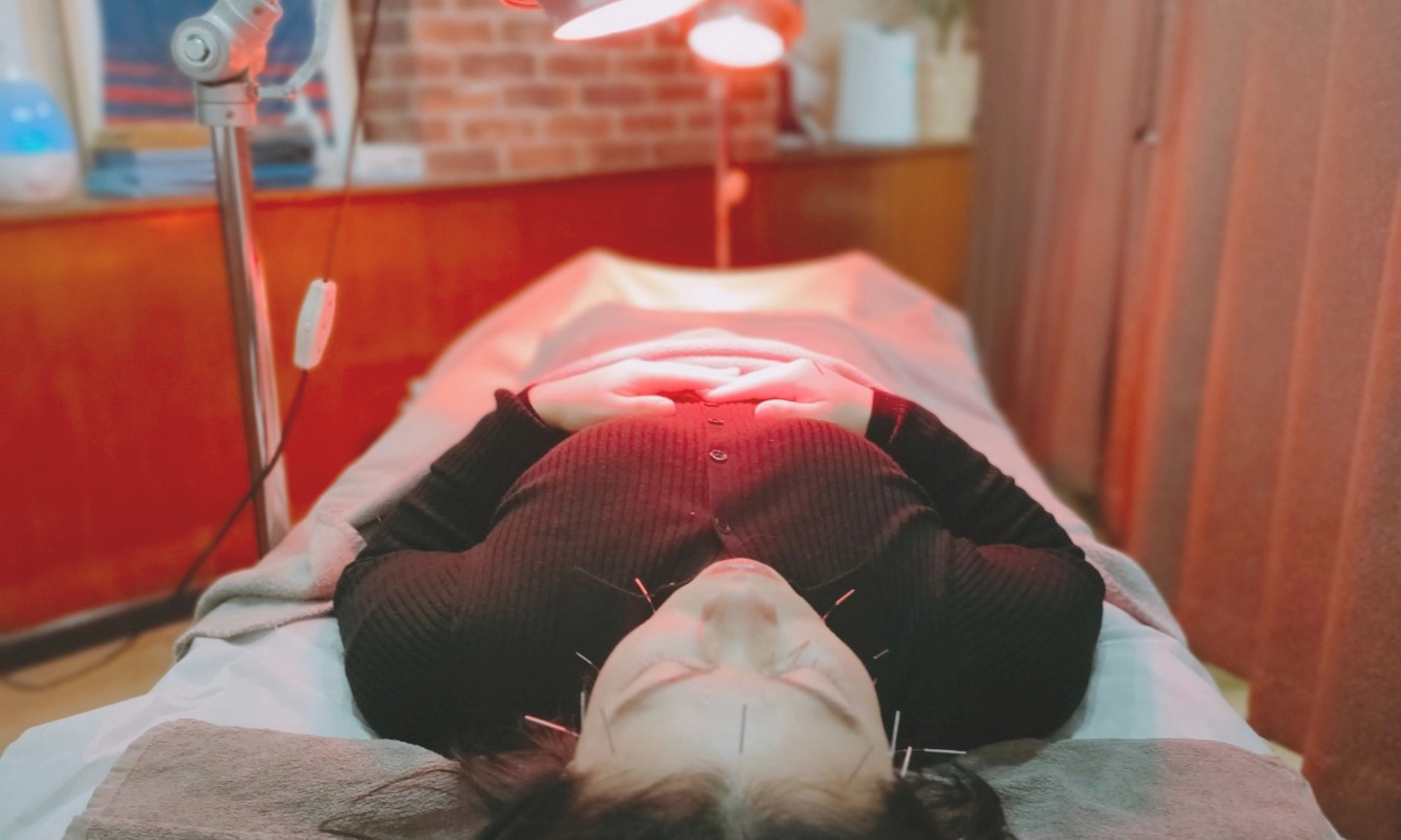 美容鍼施術風景